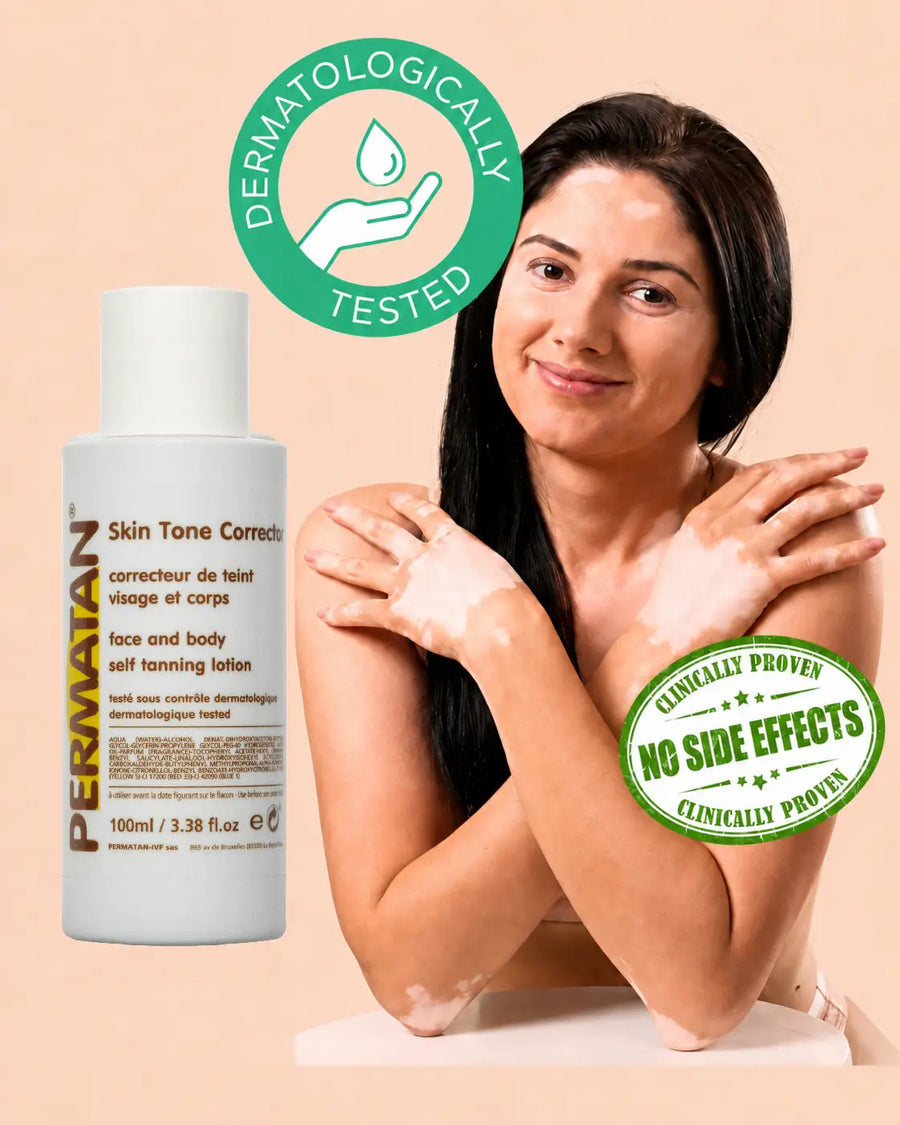 Femme atteinte de vitiligo, souriante, avec la lotion PERMATAN® correcteur de teint visage et corps